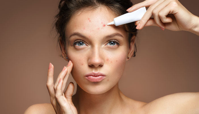 Unlocking Clear Skin: Effective Solutions for Minimizing Breakouts and Acne Scars