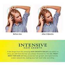 Load image into Gallery viewer, hair growth serum

