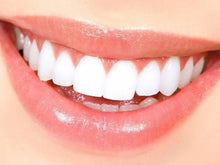 Load image into Gallery viewer, white light teeth whitening system

